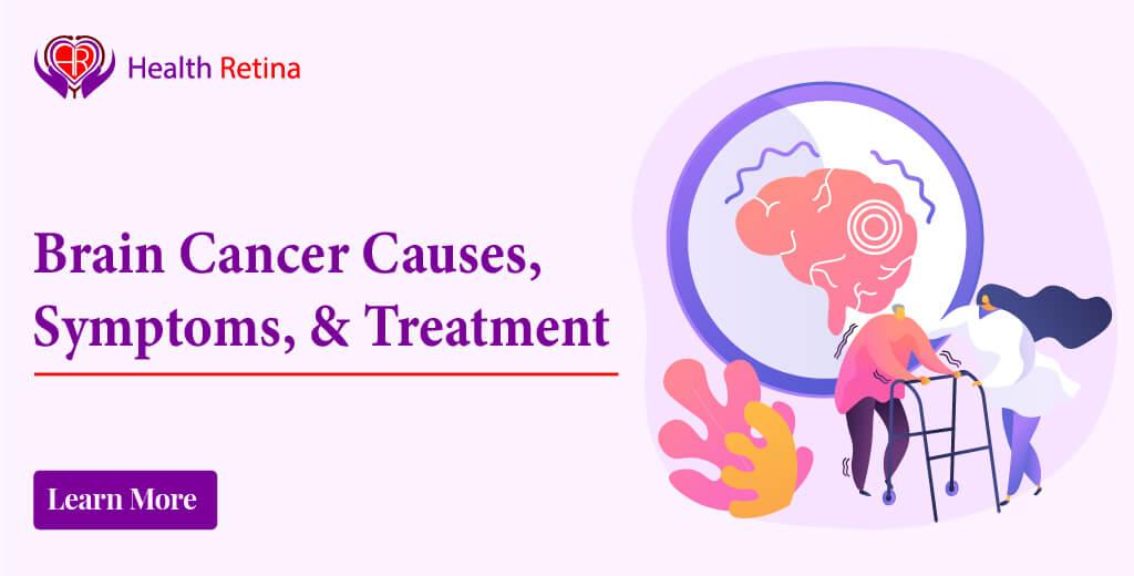 Brain Cancer: Causes, Symptoms, & Treatment
